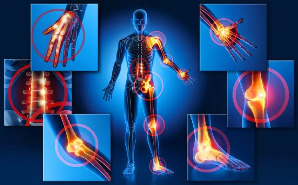 Fibromialgia: con la giusta fisioterapia e attività fisica controllata si può stare meglio