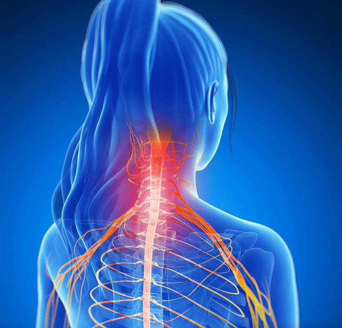 Dolore acuto che si irradia dal braccio alla parte superiore della spalla: potrebbe trattarsi della sindrome di Parsonage Turner