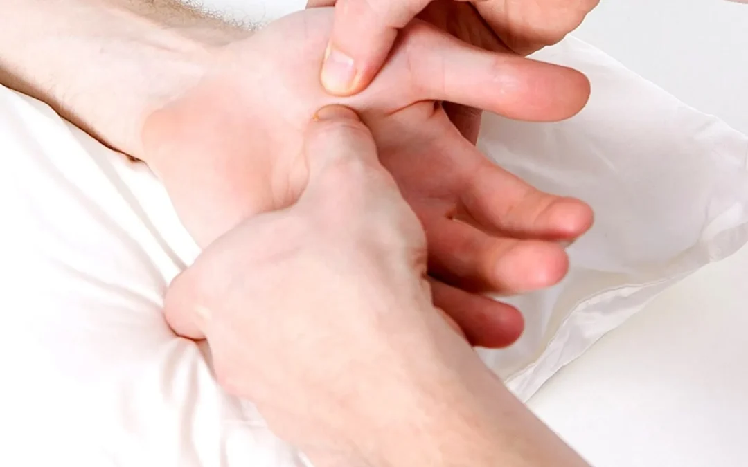 Hai difficoltà a estendere le dita della mano? Potrebbe essere il MORBO DI DUPUYTREN