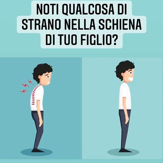 Eta’ evolutiva (lo sguardo attento per la schiena di tuo figlio)