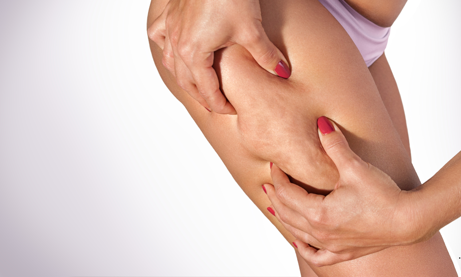 lipedema-cura