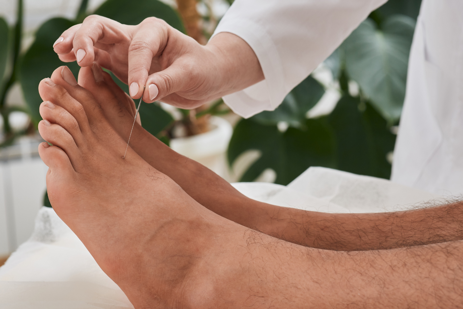 agopuntura-cosa-aspettarsi