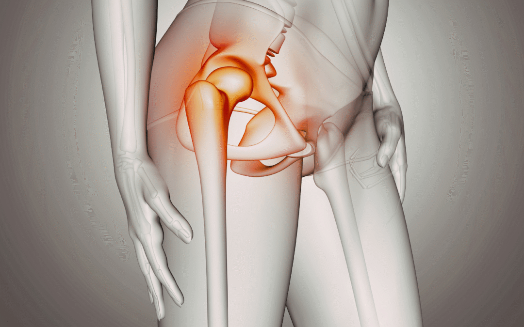 Dolore all’anca che non passa? Perché il trattamento personalizzato fa la differenza