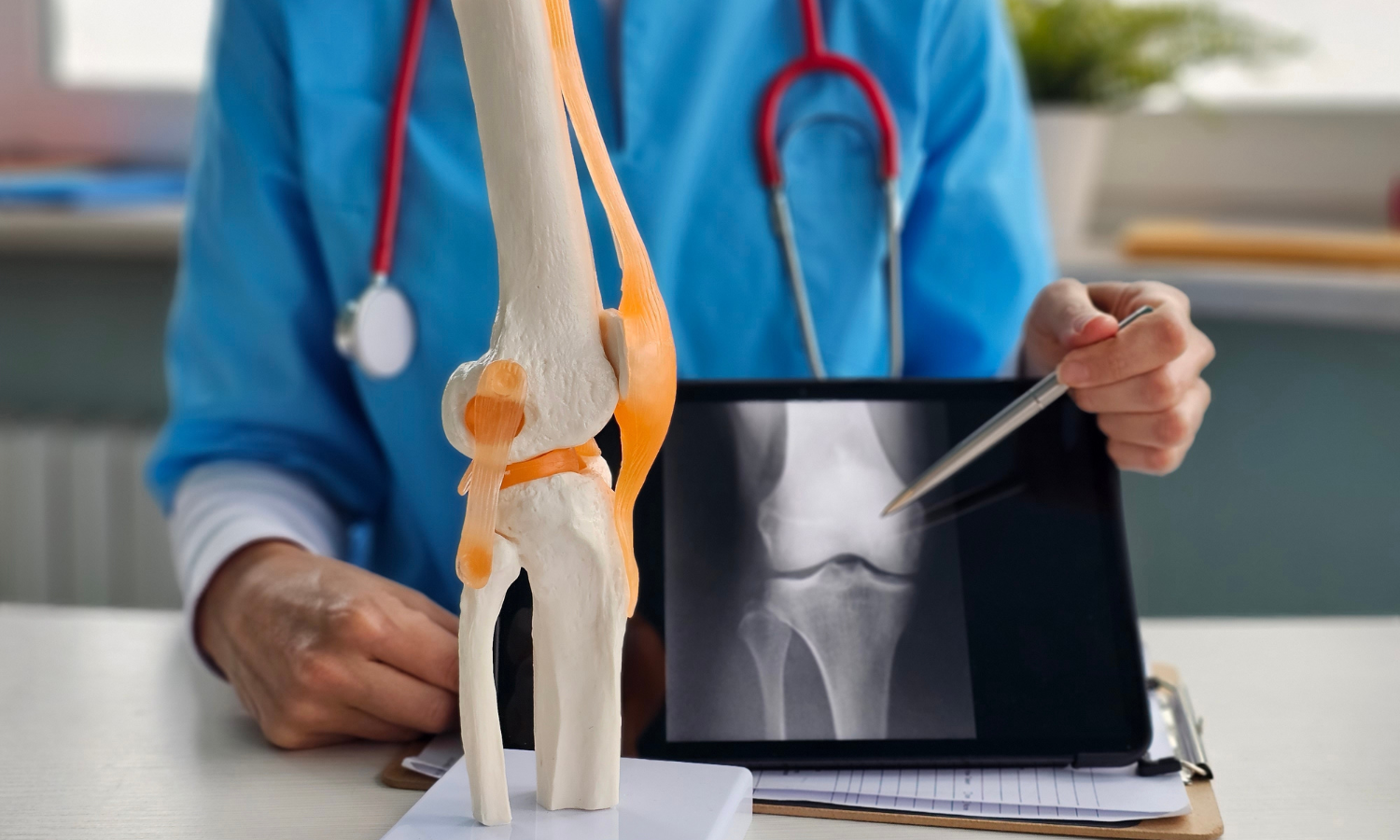 medico che indica i raggi x al ginocchio