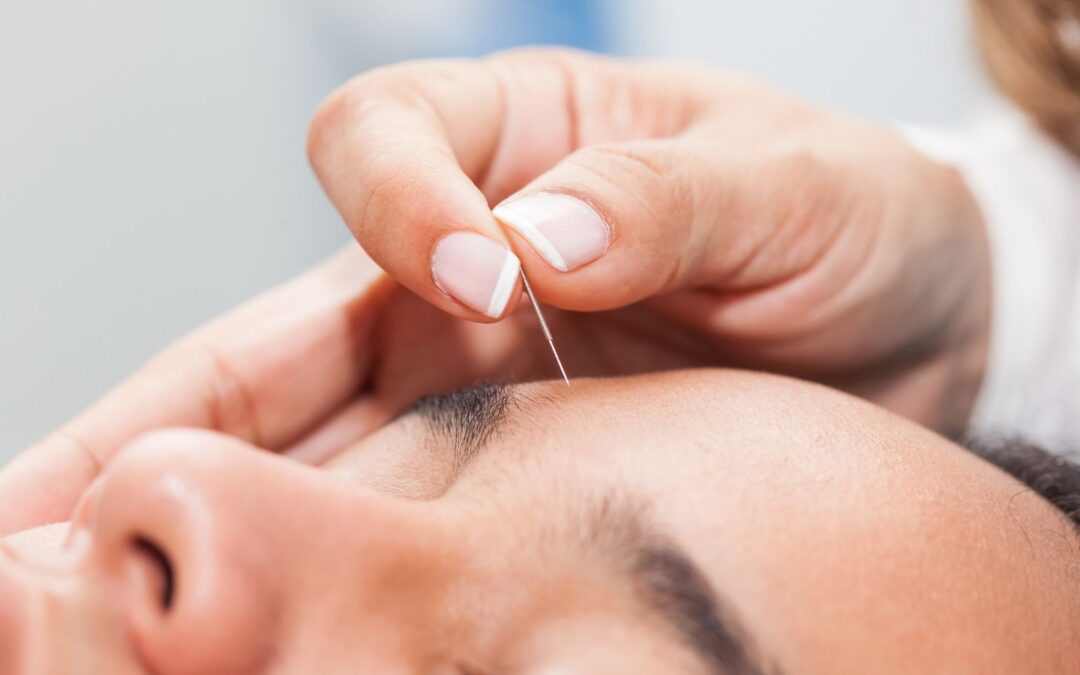 Agopuntura per insonnia e stress: come può aiutare a dormire meglio e ritrovare l’equilibrio
